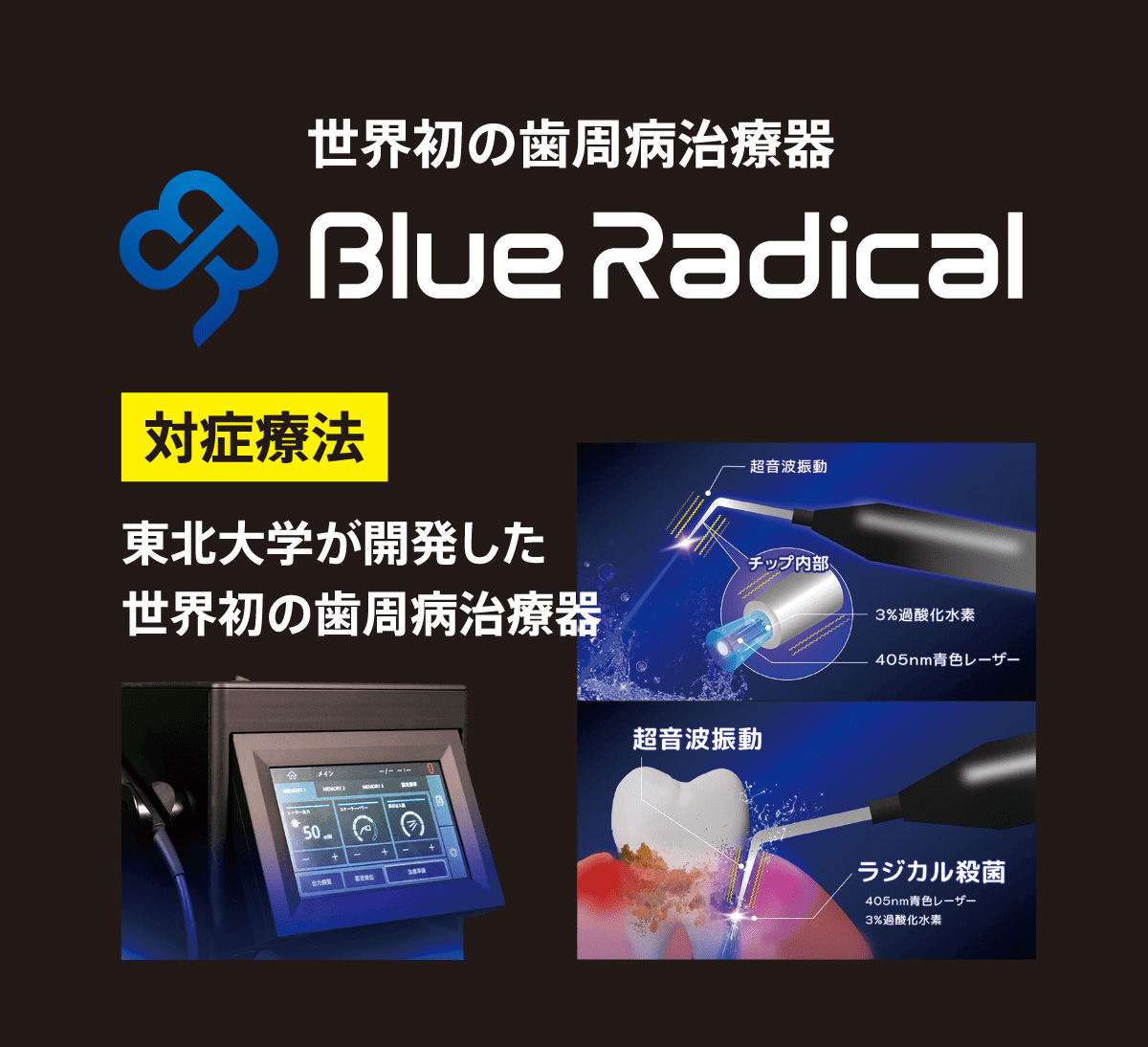 世界初の歯周病治療機器ブルーラジカル-01の導入