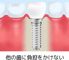 他の歯に負担をかけない